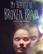 Khối óc xinh đẹp tội nghiệp của tôi My Beautiful Broken Brain